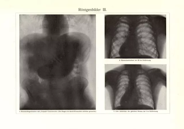 Röntgenapparate II. + Röntgenbilder III. historischer Druck Holzstich ca. 1912 2