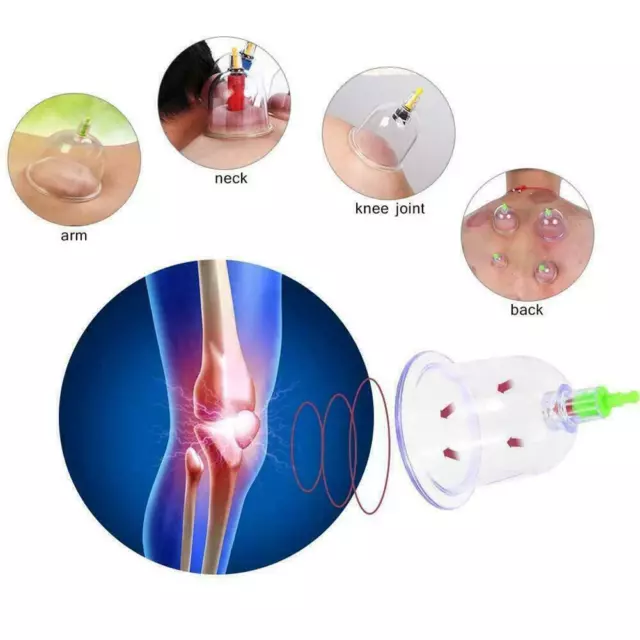 Tassen + Saugpumpe Set Körper Gesundheit Schröpftherapie Hijama Akupunktur U2J2 2