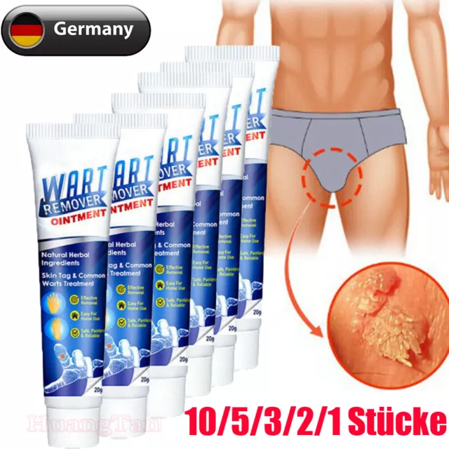 10/5Stk Warzen Entfernung Haut Tag Behandlung Creme Wart Remover Warze Entferner