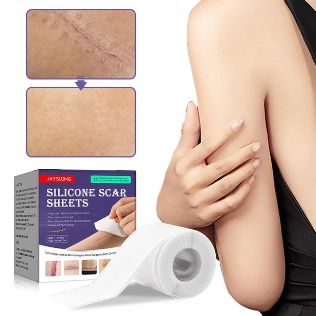 Efficiente rimozione cicatrici gel di silicone patch autoadesiva nastri in silicone F4P8
