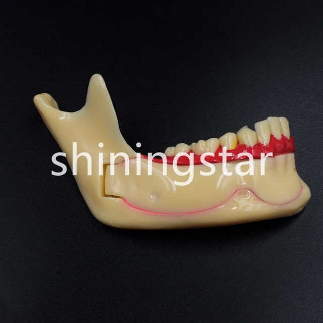 NEW DENTAL MANDIBULAR Tissue Teeth Anatomical Models Patient Study ...