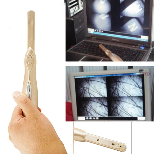 1xAuto-focus Dental HD USB 2.0 Intra Oral Camera 4 Mega Pixels 6-LED Clear Image
