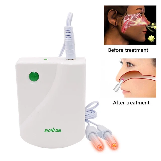 BioNase Rhiniti Nose Sinusitis Cure Therapy Hay Fever Allergy Massage Treatment☹