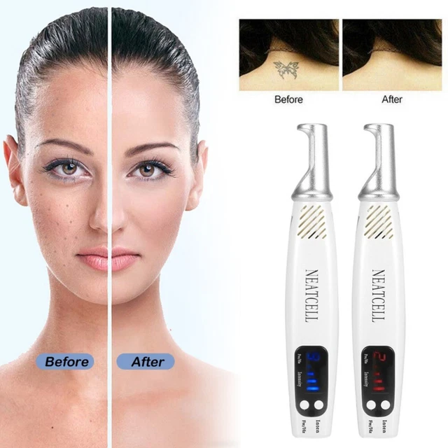 Pluma láser de picosegundos terapia de luz azul/roja para instrumentos de belleza