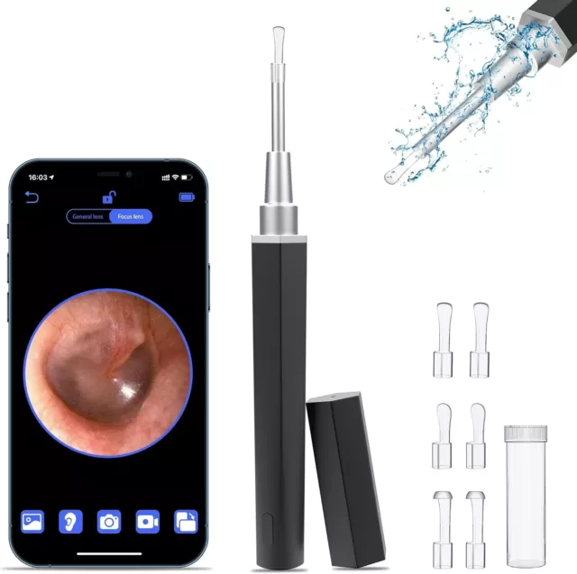 Ear Wax Removal, Ear Cleaner with Camera Earwax Remover Tool, Ear Camera Otoscop