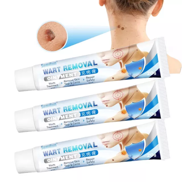 Warts Remover Antibacterial Ointment Herbal Wart Treatment Cream Skin Tj8S ID