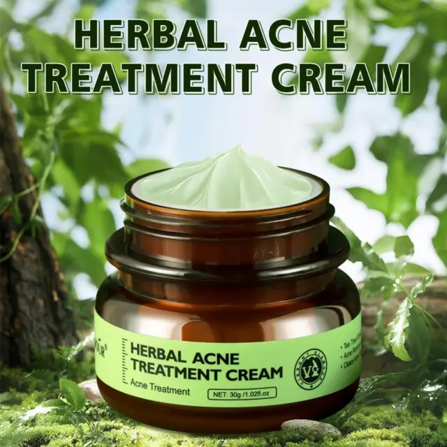 Anti acne cream Herbal scar removal oily skin Acne skin care Hot. Spots C1Y7
