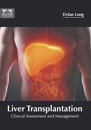 LIVER TRANSPLANTATION: CLINICAL ASSESSMENT AND MANAGEMENT By Dylan Long **NEW**