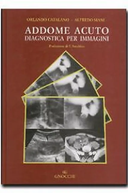 Catalano, Siani – Addome acuto – diagnostica per immagini – gnocchi – 1998