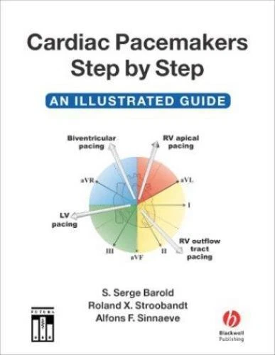 Pacemaker Algorithm Chart CARDIAC PACEMAKERS STEP-BY-STEP: An Illustrated Guide £34.88 - PicClick UK