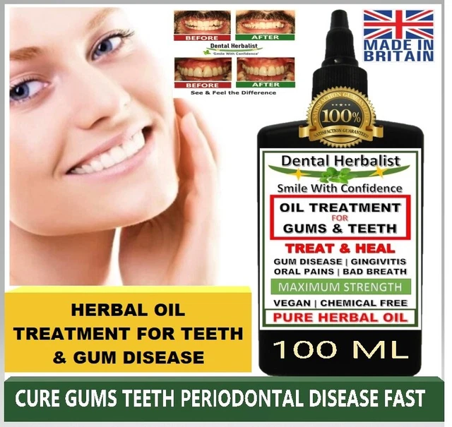 PURE HERBAL OIL ELIMINATES Gingivitis, Bleeding Receding Gums Oral Pain
