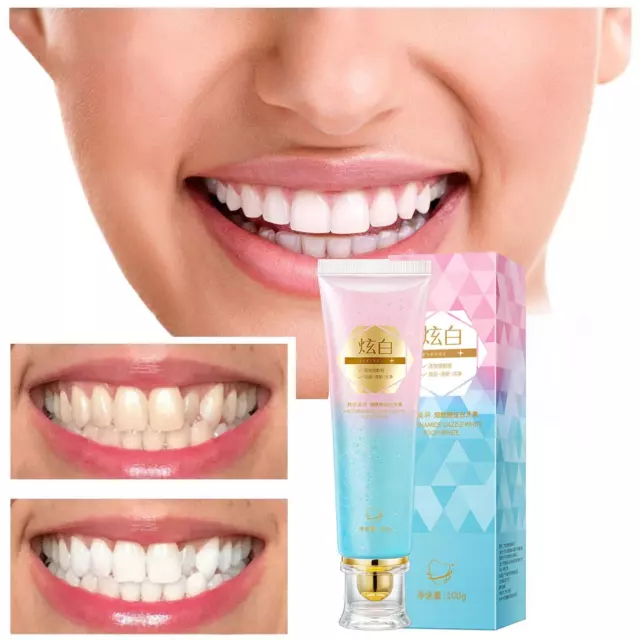 Pasta dental blanqueadora instantánea manchas oscuras nicotinamida aliento fresco oral EE. UU.