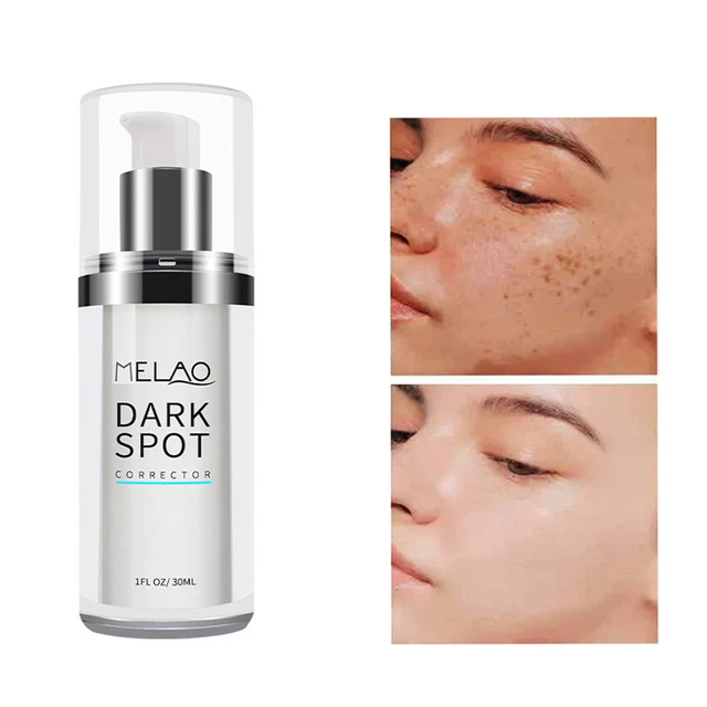 Siero correttore melanina pallido rimozione crema sbiadita essenza macchie scure melasma 30 ml