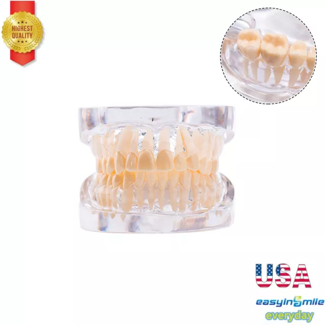 1Pc Dental Teeth Teach Adult Standard Denture Model For Patient StudyEASYINSMILE