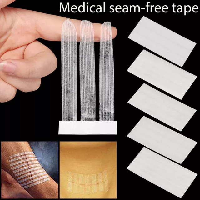 Anti-speed Beauty Tape Surgery Postpartum Skin Wound Strip Seam-free Sticker
