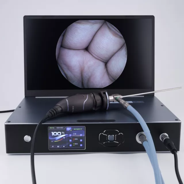 Portable Medical Endoscope Camera System Full HD 1080P with 100W LED Light