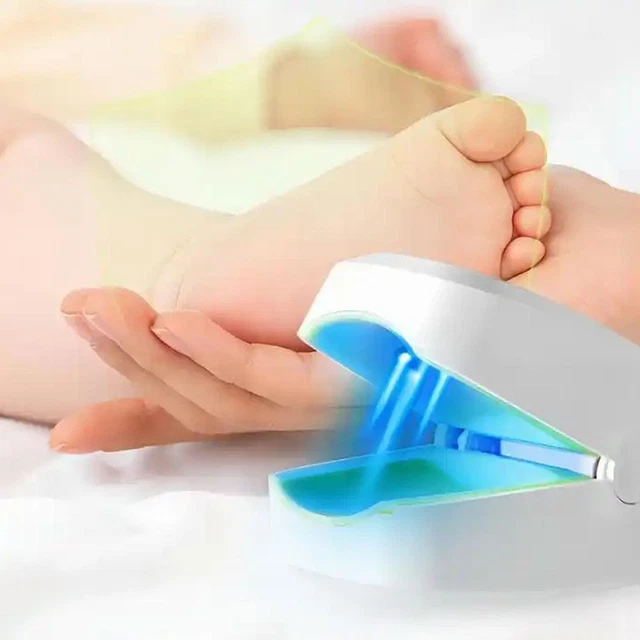 Nagelpilz Lasergerät Licht, Therapie Onychomykose Zehen BehandlungsgeräteHOT