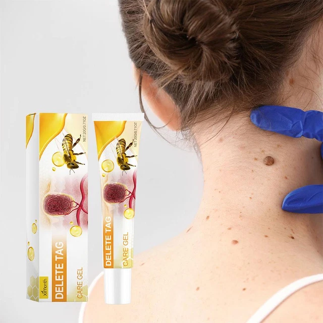 Removedor De Verrugas Y Marcas De Veneno De Abeja(3pcs) | Cuotas sin Removedor De Verrugas Y Marcas De Veneno De Abeja(3pcs) | Cuotas sin