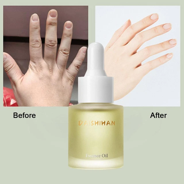 20ml Finger Slimming Serum Hand Finger Essential Oil Weight Loss 2023