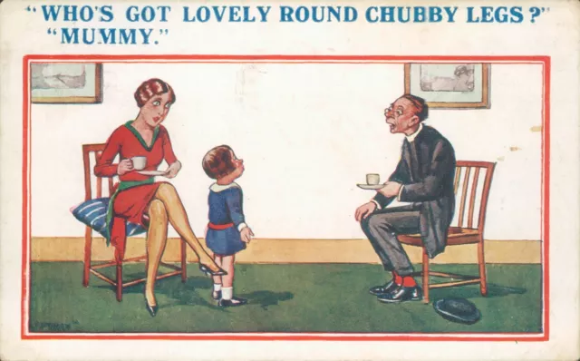 Husband and wife joke mummy fat legs 842