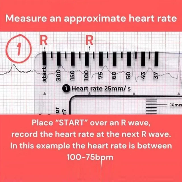 Card Ruler ECG/EKG 7STEP RULERCARDFORECG/EKG InterpretationPortable ECG EKGCard ...
