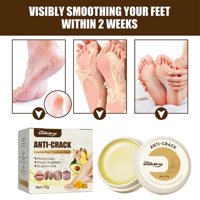 Crema para pies anti-craqueo heladas humectante pies