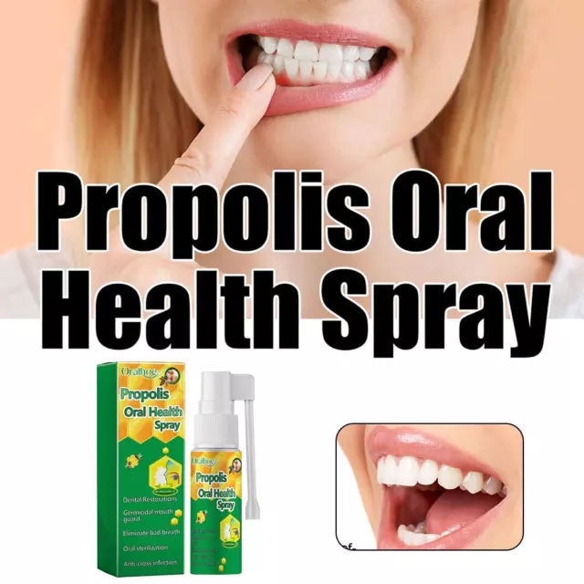 20ml Propolis Oral Spray to Clean Teeth Stains, Remove Odor and Freshen Mouth