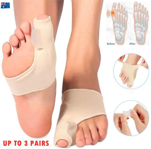 Hammer Toe Splint Bunion Corrector Straightener Orthopedic Brace Hallux Valgus