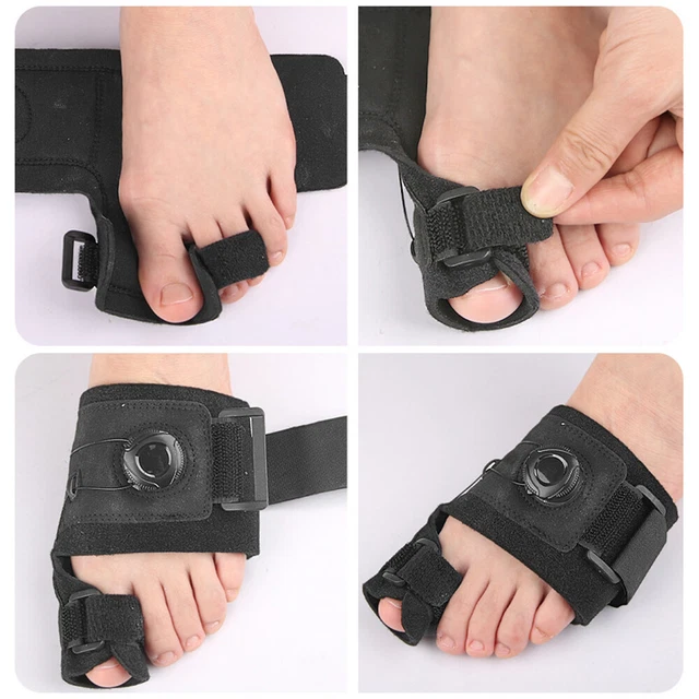 Bunion stecca supporto punta alto sollievo dal dolore stecca raddrizzatore