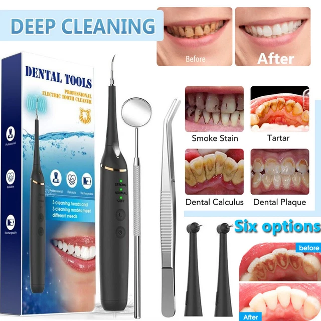 Ultrasonic Dental Scaler Electric Tooth Cleaner Calculus Remover Teeth Whitening