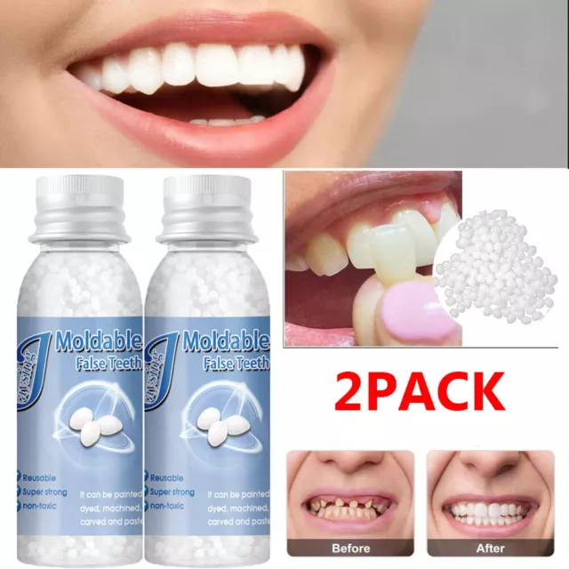 2X Tooth Repair Kit - Temporary Teeth Replacement Kit for Missing & Broken Teeth