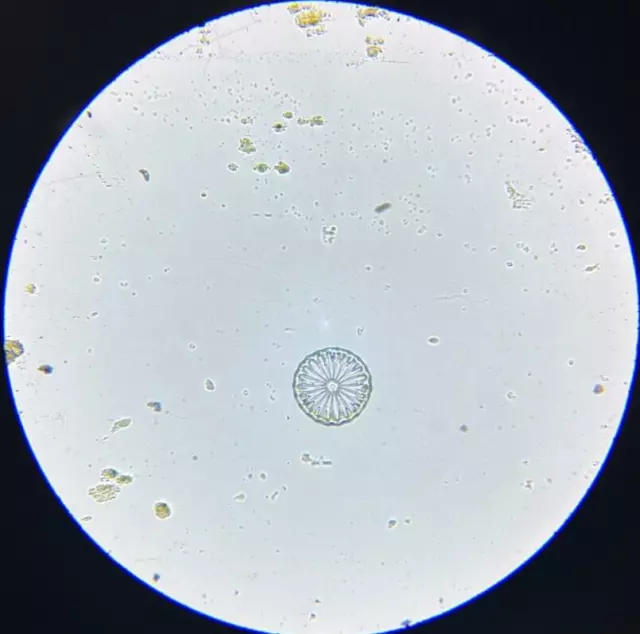 J.D. Moller Microscope Slide Sea Cucumber Myriotrochus Rinkii Steen. Greenland