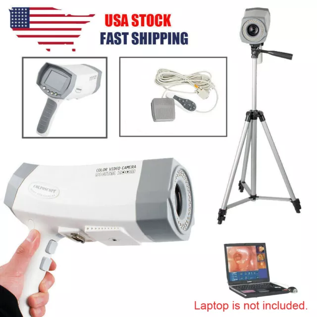 Digital Video Electronic Colposcope 480000 Pixels Zoom Camera +Tripod + Software
