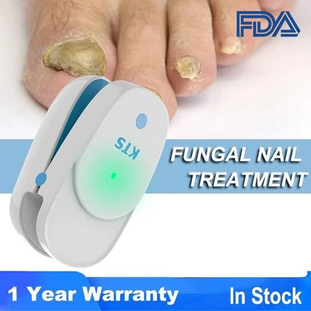 FUNGAL NAIL TREATMENT Laser Device 905nm470nm Fungus Nail Removal Anti