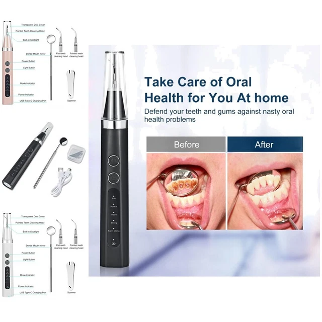 1 set detergente denti ad ultrasuoni cura dentale portatile ultrasuoni elettrici orali