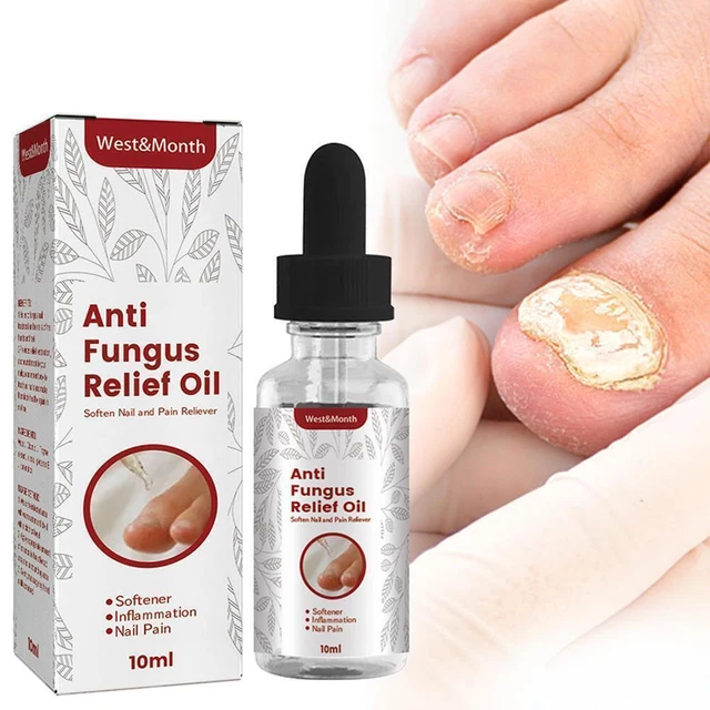 Aceite de alivio rápido de onicomicosis tratamiento de uñas de onicomicosis ∑