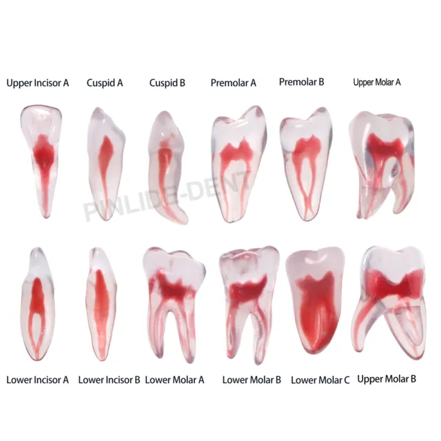 Dental Resin Root Canal Teeth Model Endo Practice Block RCT Pulp Cavity Study
