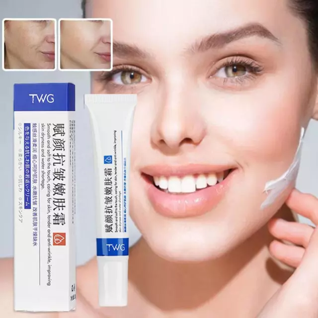 Effective Whitening Freckle Cream Remove Dark Spots Anti Oil-control Pores' ☆ο