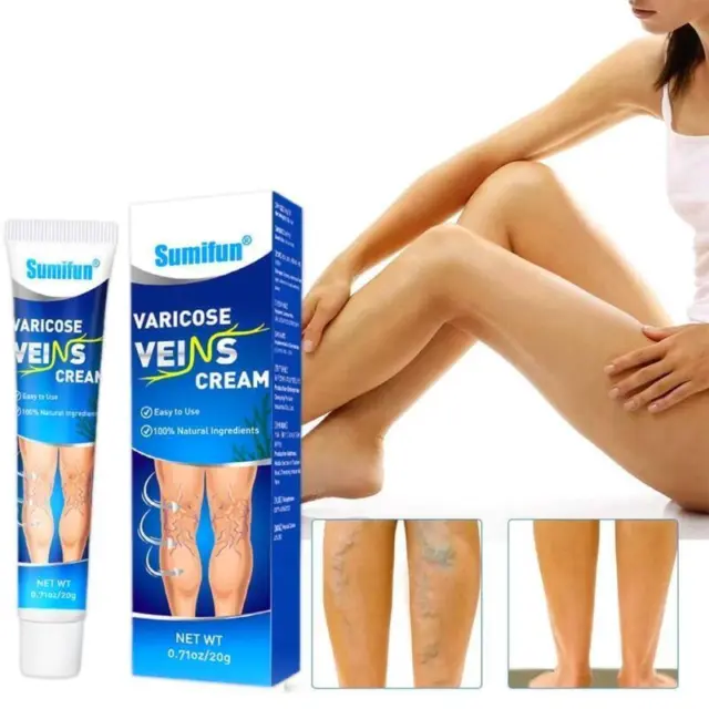 Crema eficaz contra las venas varicosas - tratamiento natural de piernas. Envío rápido