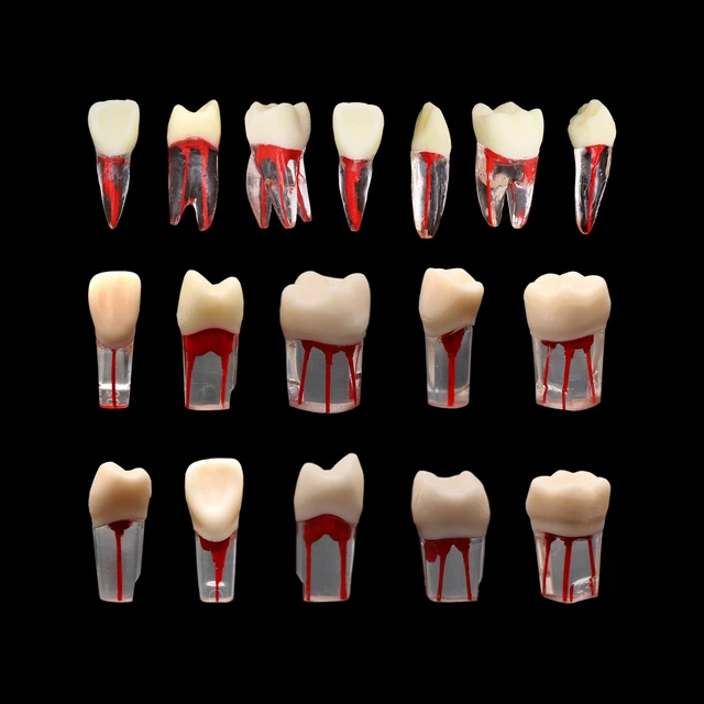 Rct Endo Block DENTAL ENDO TOOTH Root Canal Pulp Cavity Model RCT Training Block ...