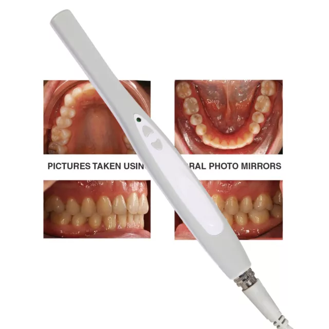 Dental Camera Scanner Intraoral Digital USB Imaging System Oral 6 LED Light -X