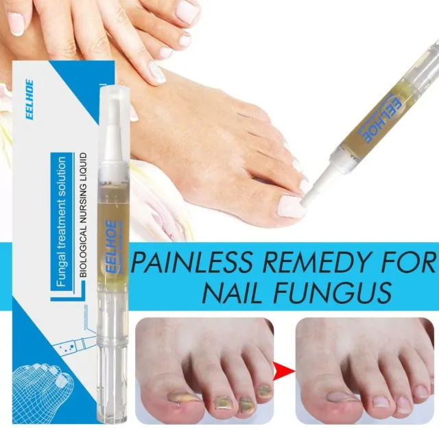 3ml Vernis à ongles anti-fongique  Nail