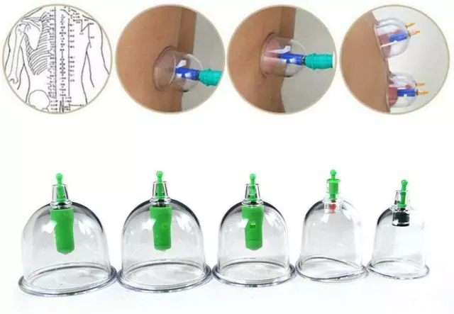 Pain Relief 24 Cups Vacuum Cupping Set Massage Kit Acupuncture Suction Massager 3