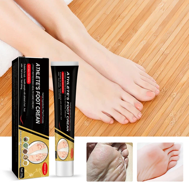 Athlete's Foot Refreshing Health Care Cream Skin Itching Relief E