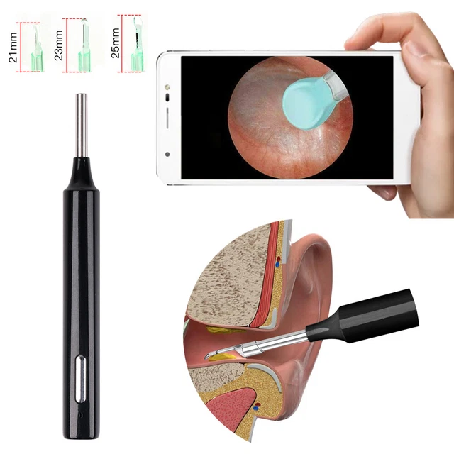 Removedor de cera para oídos cámara endoscopio cuchara escoge kit de herramientas de limpieza HD limpiador nuevo