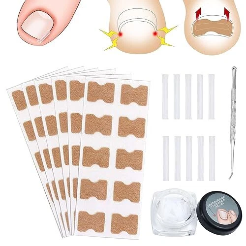 Autocollants de Correction,Ensemble d'Outil Ongle Incarné,Autocollant de Correct