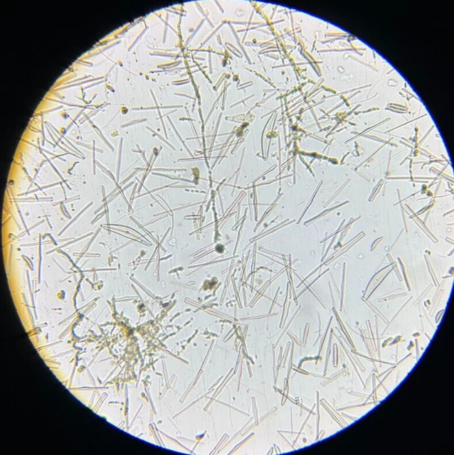 19th c J.D. Moller Microscope Slide Diatom Holstein Germany Epithemia Gibba Kg.