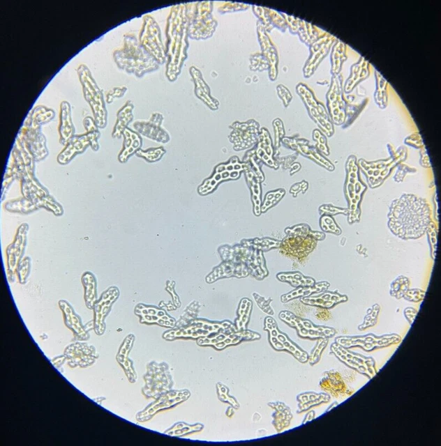 J.D. Moller Microscope Slide Sea Cucumber Cucumaria Hyndmanii Thomp. North Sea