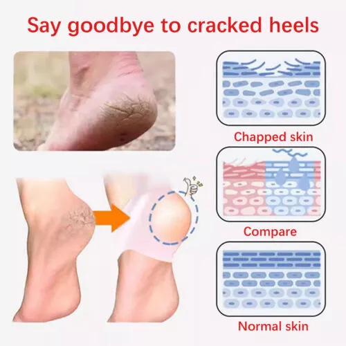 Silicone Gel Heel Socks Cracked Foot Skin Care Protector Sleeve Pain Relief