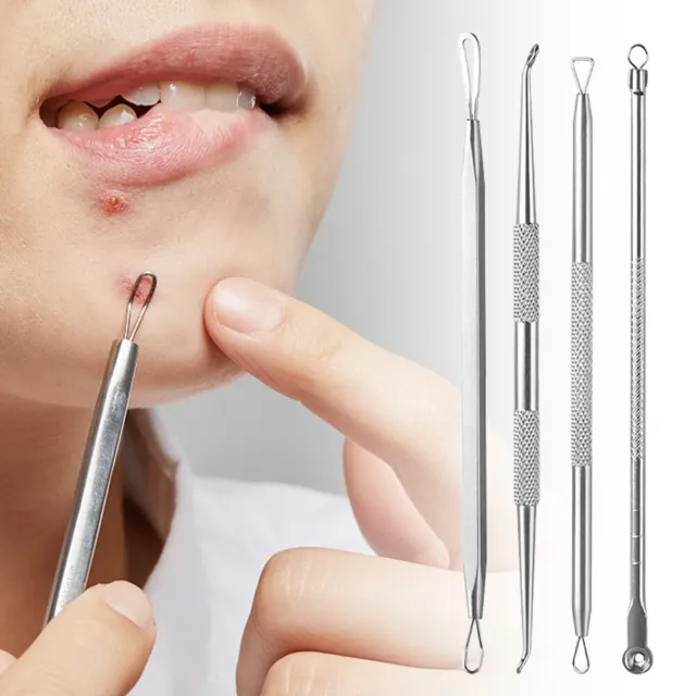 Acne Pimple Comedone Extractor Blackhead Remover Set Stainless Steel